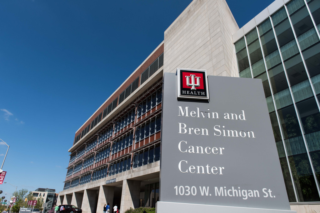 IU researchers play role in development of new bladder cancer treatment